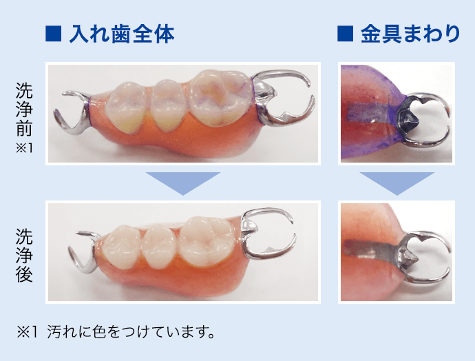 デントヘルス超音波入れ歯クリーンキット/除菌液 | デントヘルスの