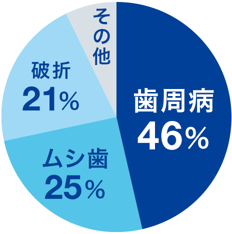 50代～歯の抜歯原因（2018年度公益財団法人8020推進財団調査）歯周病 46%、ムシ歯25%、破折21%、その他