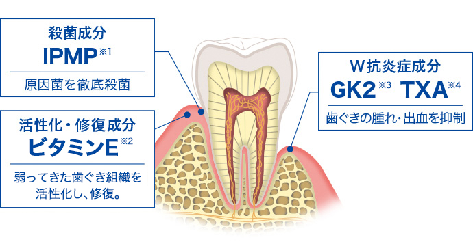 殺菌成分 IPMP ※1 活性化・修復成分 アラントイン 弱ってきた歯ぐき組織を 活性化し、修復。 W抗炎症成分 GK2 ※2 TXA ※3 歯ぐきの腫れ・出血を抑制