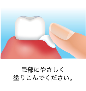 患部にやさしく塗り込んでください。
