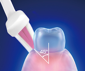 Firmly polish the boundary between teeth and gums